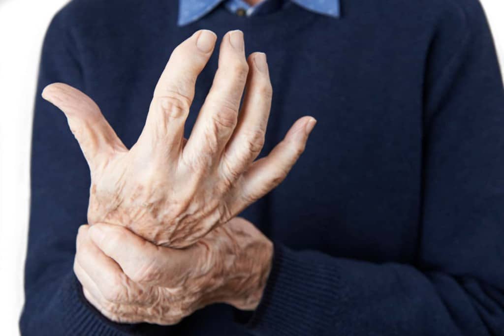 Elderly man holding hand his hand, displaying sever arthritis