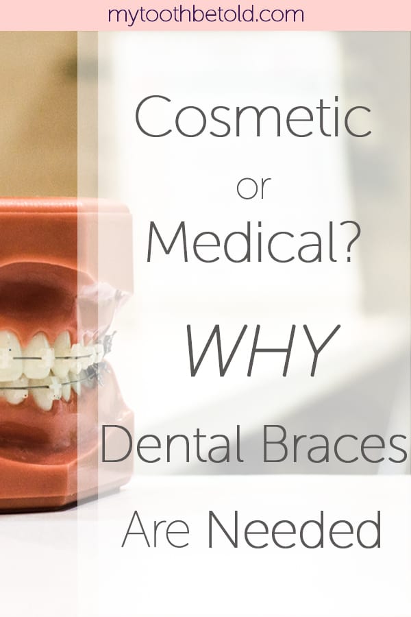 Cosmetic or Medical? Reasons Why Dental Braces Are Needed – Tooth Be Told