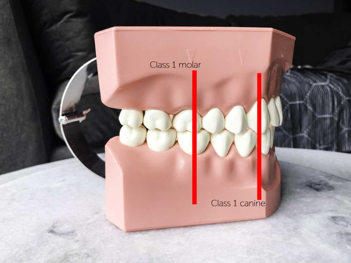 Perfect Bite: How Teeth Should Line Up and Come Together – Tooth Be Told