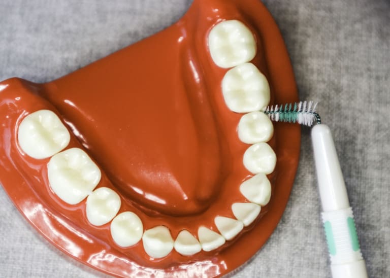 Cleaning Under Your Dental Bridge Made Easy With Pictures Tooth Be Told