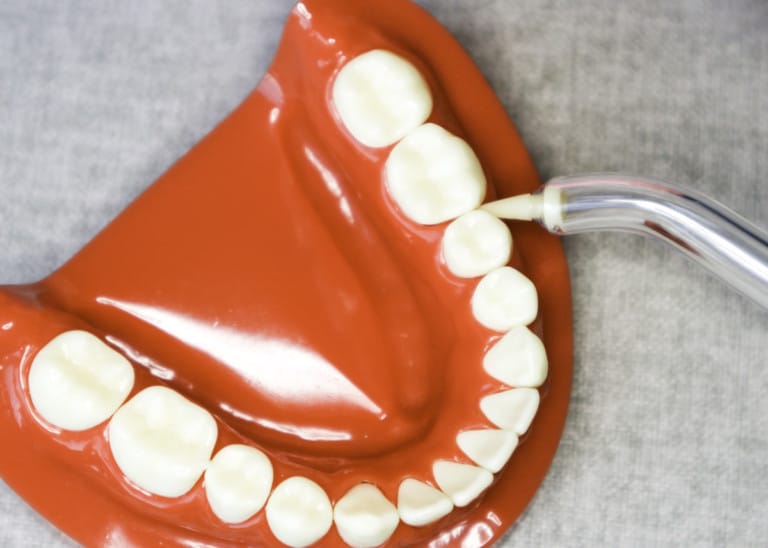 Cleaning Under Your Dental Bridge Made Easy With Pictures Tooth Be Told