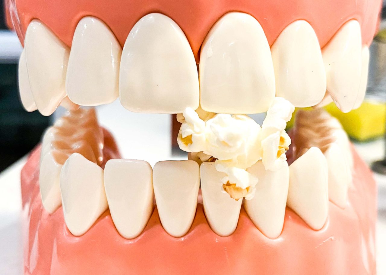 Popcorn teeth. A tooth model biting on a piece of popcorn between the front teeth. 