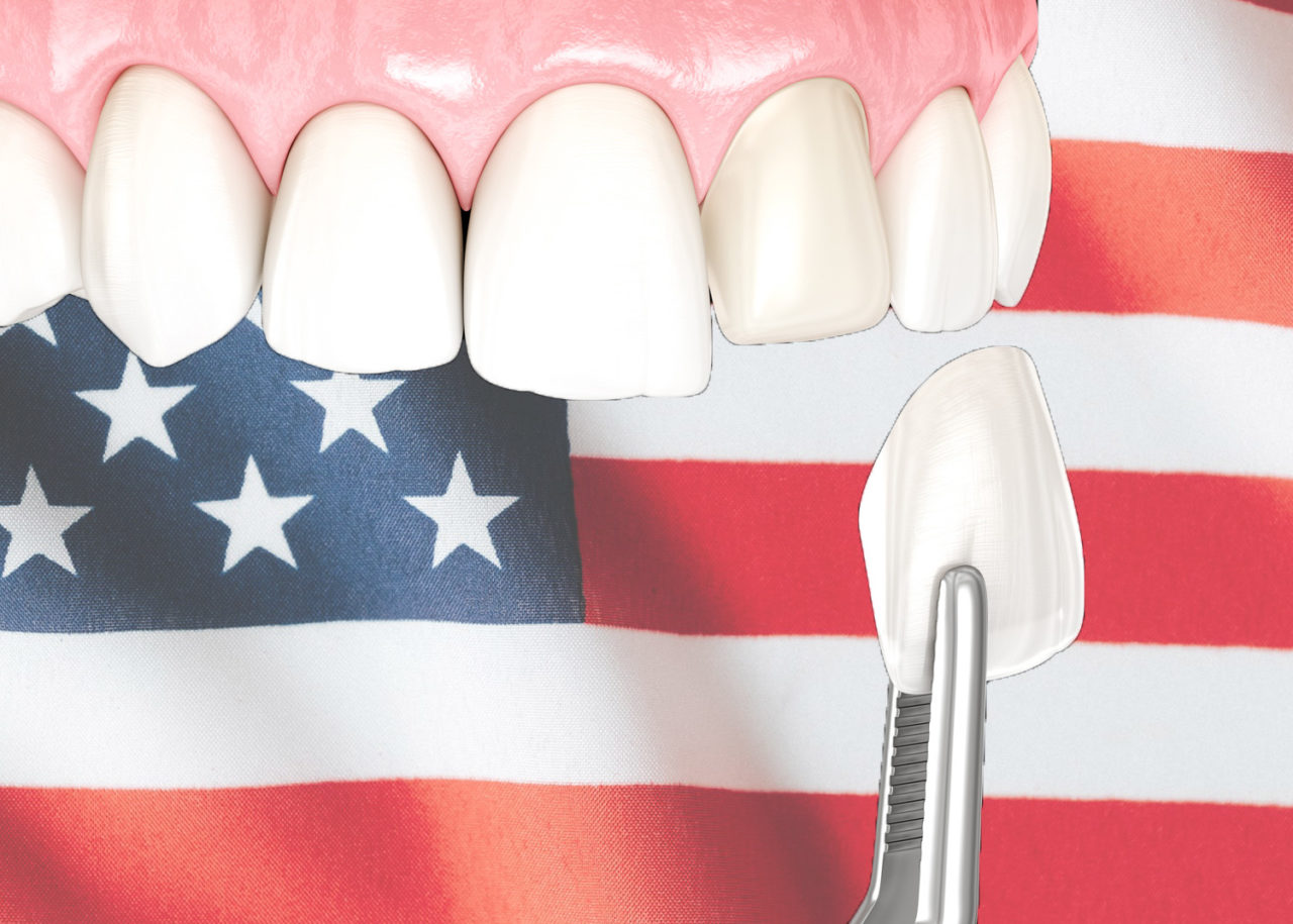 Picture of dental veneers on top of an USA flag